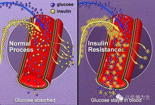 Ⅱ型糖尿病的發病機理